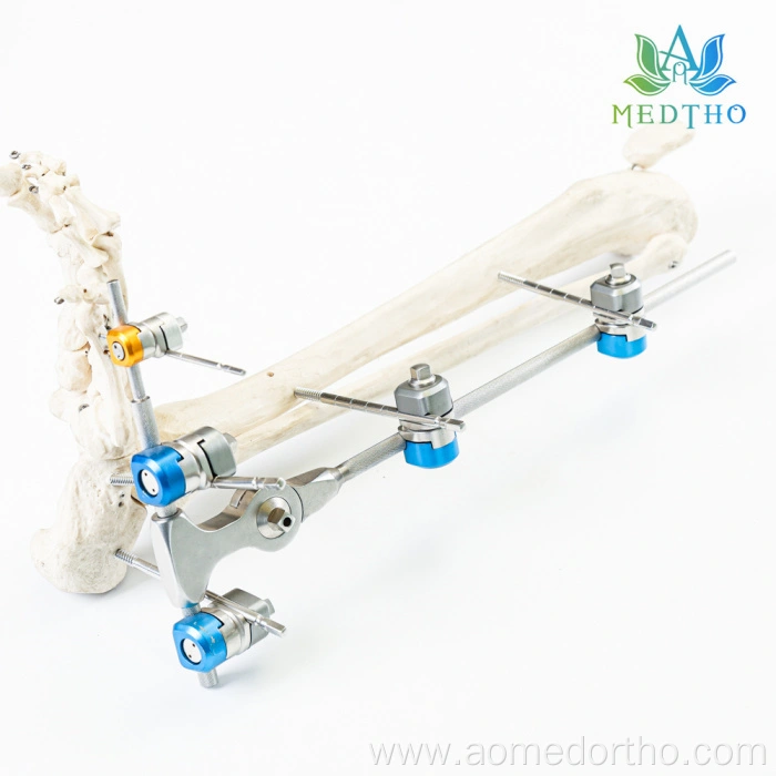 foot external fixator